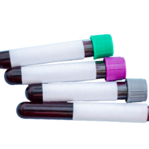 Tubos para coleta de sangue a vácuo